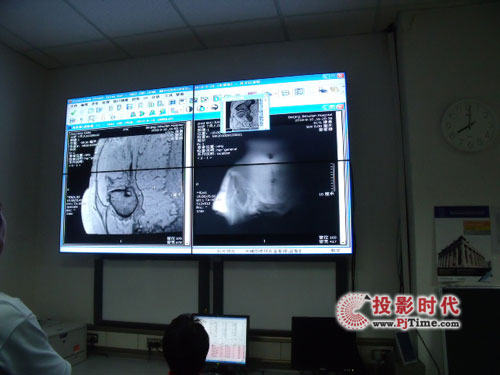 海視天恒為北京積水潭醫院組建拼接屏